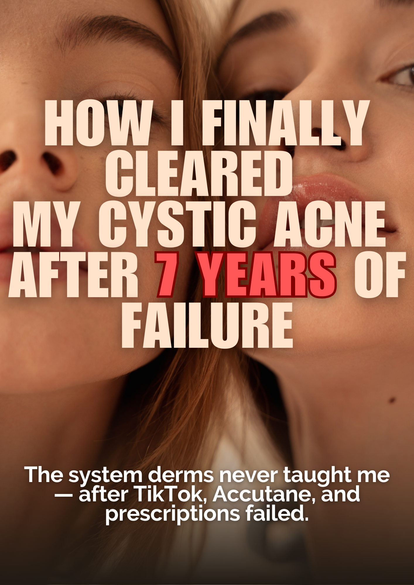How I Finally Cleared My Cystic Acne After 7 Years of Failure